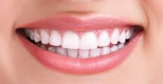 Diş Beyazlatma ve Diş Sararması