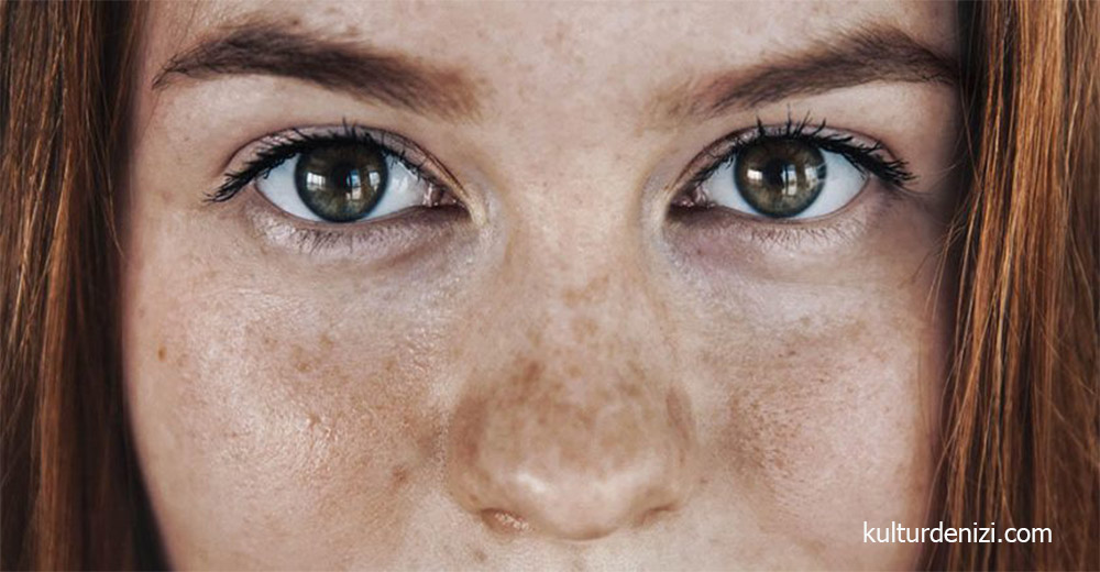 Pigmentasyon Nedir?